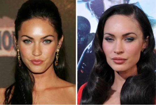 angelina jolie teeth before and after. looks like Angelina Jolie,